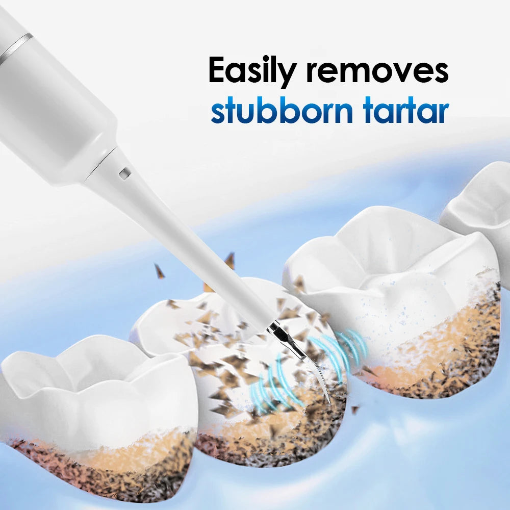 Electric Sonic Dental Scaler for Plaque, Tartar & Stain Removal