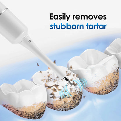 Electric Sonic Dental Scaler for Plaque, Tartar & Stain Removal